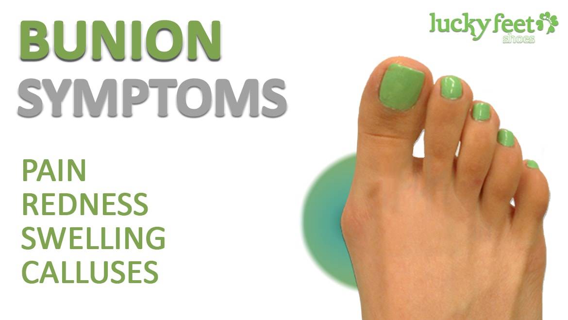 Check Out Our Tips to Help Treat Your Bunions at Home