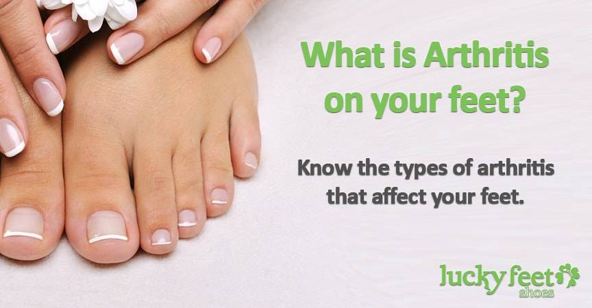 types-of-arthritis-that-affect-feet-osteoarthritis