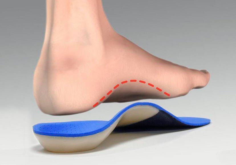 the best arch support