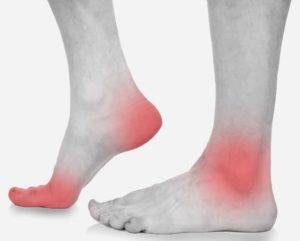 Types of Arthritis that Affect Your Feet - Lucky Feet Shoes