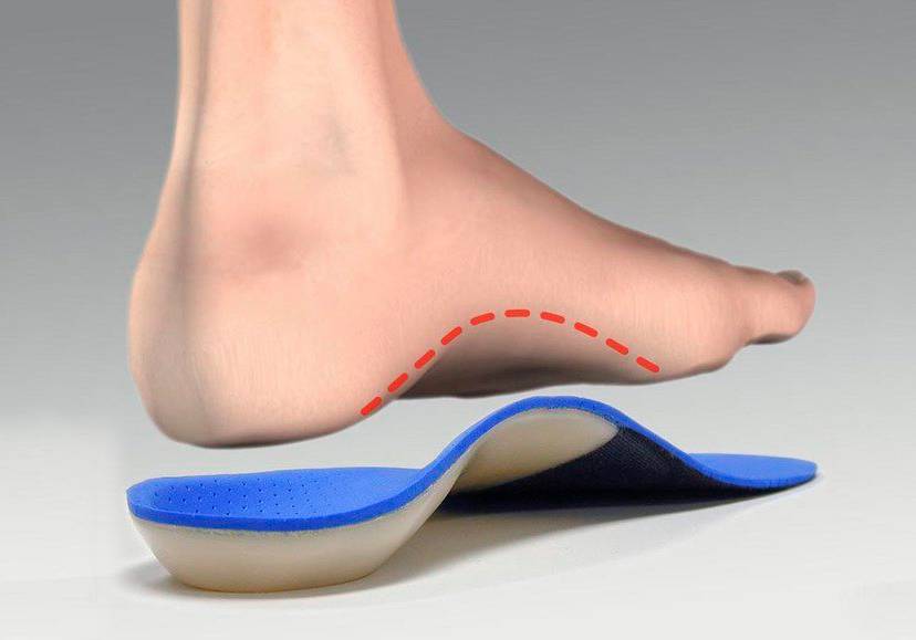Best arch supports for Plantar 