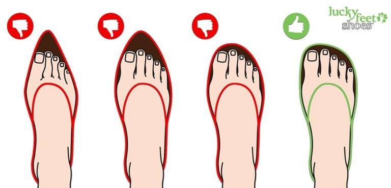 Reduce Bunion Pain with Comfortable Shoes | Lucky Feet Shoes